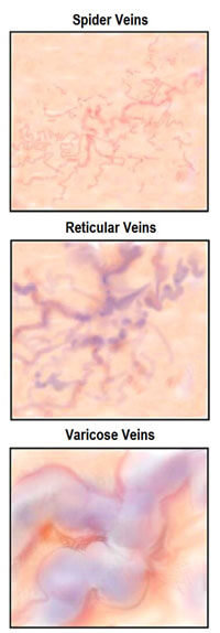 reticular veins