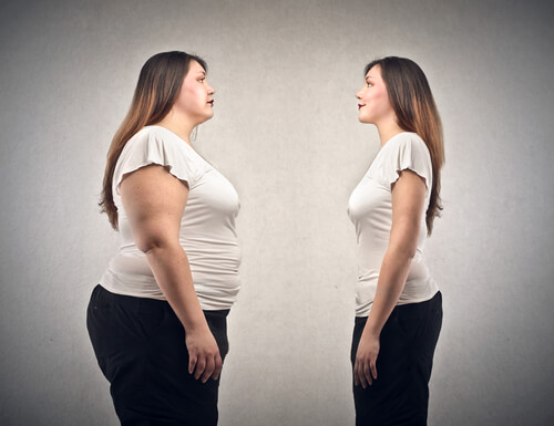 Sabías que la obesidad y el peso afectan a las varices?
